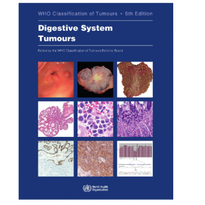 WHO's Classification of Tumours: Breast Tumours; 5th Edition 2019
